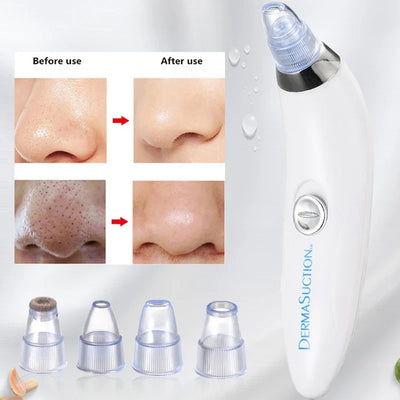 Derma Pore Cleaner Acne Oil Remover Vacuum Face Pore Cleaner Facial Beauty Equipment